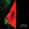 Figure 1   A confocal micrograph of resin-infiltrated enamel caries lesion in a deciduous molar demonstrates how the infiltrant (red) seals the lesion from the proximal tooth surface inward. Lesion pores beyond the seal (green) are cut off from further diffusion of bacteria and nutrients (figure courtesy of S. Paris and H. Meyer-Lueckel).